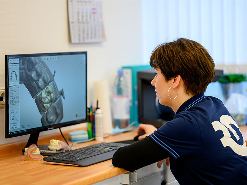 Cad/Cam cad-cam